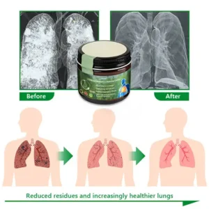 𝗟𝗲𝗿𝗰𝗲𝗮™ 𝗠𝘂𝗹𝗹𝗲𝗶𝗻 𝗖𝗹𝗲𝗮𝗿 𝗟𝘂𝗻𝗴 𝗥𝗲𝗽𝗮𝗶𝗿 𝗖𝗿𝗲𝗮𝗺