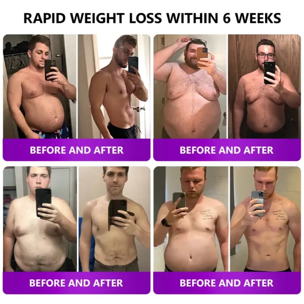 𝑳𝒆𝒓𝒄𝒆𝒂® 𝑺𝑴𝑮𝑻-𝑮𝑳𝑷-1 𝑵𝒂𝒏𝒐 𝑴𝒊𝒄𝒓𝒐𝒏𝒆𝒆𝒅𝒍𝒆 𝑺𝒍𝒊𝒎𝒎𝒊𝒏𝒈 𝑷𝒂𝒕𝒄𝒉