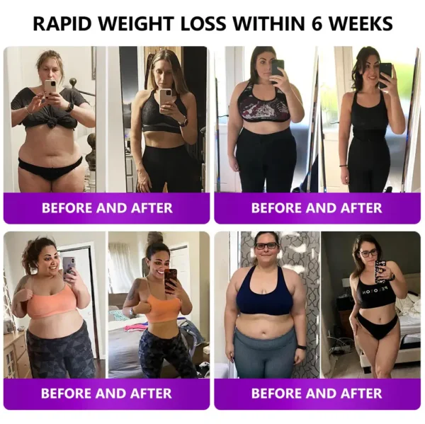 𝑳𝒆𝒓𝒄𝒆𝒂® 𝑺𝑴𝑮𝑻-𝑮𝑳𝑷-1 𝑵𝒂𝒏𝒐 𝑴𝒊𝒄𝒓𝒐𝒏𝒆𝒆𝒅𝒍𝒆 𝑺𝒍𝒊𝒎𝒎𝒊𝒏𝒈 𝑷𝒂𝒕𝒄𝒉