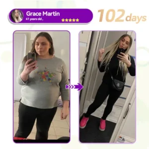 𝑳𝒆𝒓𝒄𝒆𝒂® 𝑺𝑴𝑮𝑻-𝑮𝑳𝑷-1 𝑵𝒂𝒏𝒐 𝑴𝒊𝒄𝒓𝒐𝒏𝒆𝒆𝒅𝒍𝒆 𝑺𝒍𝒊𝒎𝒎𝒊𝒏𝒈 𝑷𝒂𝒕𝒄𝒉
