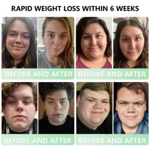 𝐋𝐞𝐫𝐜𝐞𝐚® GLP-1 Slimming & Health Boost Drops
