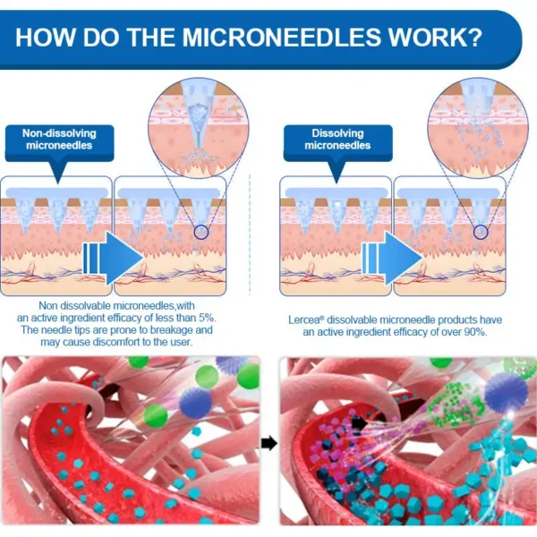 LERCEA® SMGT-GLP-1 Tirzepatide & Collagen Nano Microneedle Weight Loss Patch