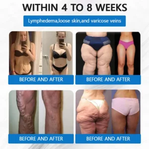 LERCEA® SMGT-GLP-1 Tirzepatide & Collagen Nano Microneedle Weight Loss Patch