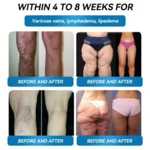 𝗟𝑬𝗥𝗖𝑬𝗔® 𝗚𝗟𝑃-𝟭 Super Concentrated Weight Loss Gum