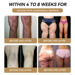 ๐
๐๐-๐๐พ๐ซ๐ญ๐ข๐๐ข๐พ๐ ๐๐๐๐ข๐๐ข๐๐ฅ ๐๐ญ๐ผ๐ซ๐!๐ฉโโ๏ธ|๐๐๐๐๐๐๐๐ผยฎ ๐๐๐-๐ ๐๐๐ฅ๐ญ๐ข๐๐๐ง๐๐ญ๐ข๐ผ๐ป๐๐ฅ ๐๐ซ๐๐ฅ ๐๐ข๐ป๐ ๐ฅ๐พ-๐๐ผ๐ฌ๐พ ๐๐ฆ๐ฉ๐ผ๐๐ฅ๐พ๐ฌ (๐๐ฎ๐ฌ๐ญ ๐จ๐ง๐๐ ๐ ๐๐๐ฒ, ๐ฏ๐ข๐ฌ๐ข๐๐ฅ๐ ๐๐ก๐๐ง๐ ๐๐ฌ ๐ข๐ง ๐ ๐๐๐ฒ๐ฌ) ๐๐ฎ๐ข๐ญ๐๐๐ฅ๐ ๐๐จ๐ซ ๐จ๐๐๐ฌ๐ข๐ญ๐ฒ, ๐๐ข๐๐๐๐ญ๐๐ฌ, ๐๐ฅ๐จ๐จ๐ ๐ฌ๐ฎ๐ ๐๐ซ ๐๐๐ฅ๐๐ง๐๐, ๐๐ง๐ญ๐ข-๐๐ ๐ข๐ง๐ , ๐๐จ๐ง๐ ๐๐ง๐ ๐ฃ๐จ๐ข๐ง๐ญ ๐ข๐ฌ๐ฌ๐ฎ๐๐ฌ, ๐๐ง๐ ๐ฆ๐จ๐ซ๐โจ