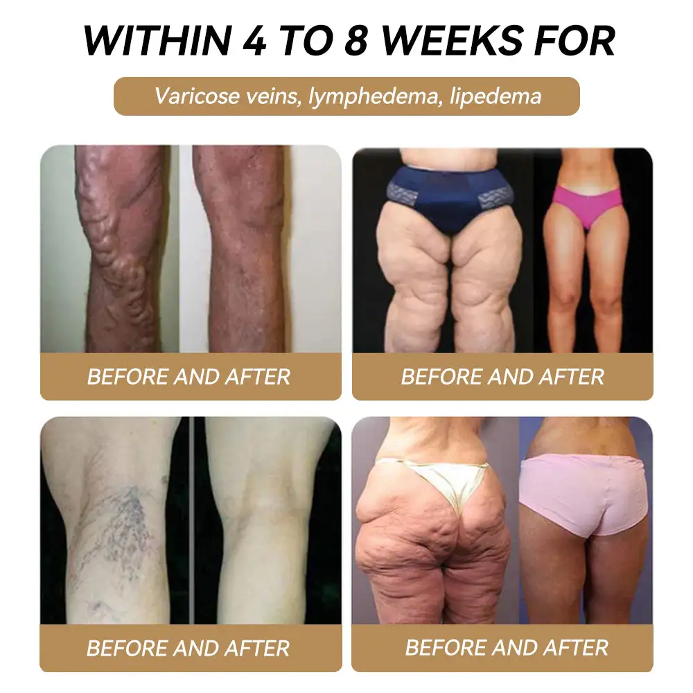 ๐
๐๐-๐๐พ๐ซ๐ญ๐ข๐๐ข๐พ๐ ๐๐๐๐ข๐๐ข๐๐ฅ ๐๐ญ๐ผ๐ซ๐!๐ฉโโ๏ธ|๐๐๐๐๐๐๐๐ผยฎ ๐๐๐-๐ ๐๐๐ฅ๐ญ๐ข๐๐๐ง๐๐ญ๐ข๐ผ๐ป๐๐ฅ ๐๐ซ๐๐ฅ ๐๐ข๐ป๐ ๐ฅ๐พ-๐๐ผ๐ฌ๐พ ๐๐ฆ๐ฉ๐ผ๐๐ฅ๐พ๐ฌ (๐๐ฎ๐ฌ๐ญ ๐จ๐ง๐๐ ๐ ๐๐๐ฒ, ๐ฏ๐ข๐ฌ๐ข๐๐ฅ๐ ๐๐ก๐๐ง๐ ๐๐ฌ ๐ข๐ง ๐ ๐๐๐ฒ๐ฌ) ๐๐ฎ๐ข๐ญ๐๐๐ฅ๐ ๐๐จ๐ซ ๐จ๐๐๐ฌ๐ข๐ญ๐ฒ, ๐๐ข๐๐๐๐ญ๐๐ฌ, ๐๐ฅ๐จ๐จ๐ ๐ฌ๐ฎ๐ ๐๐ซ ๐๐๐ฅ๐๐ง๐๐, ๐๐ง๐ญ๐ข-๐๐ ๐ข๐ง๐ , ๐๐จ๐ง๐ ๐๐ง๐ ๐ฃ๐จ๐ข๐ง๐ญ ๐ข๐ฌ๐ฌ๐ฎ๐๐ฌ, ๐๐ง๐ ๐ฆ๐จ๐ซ๐โจ