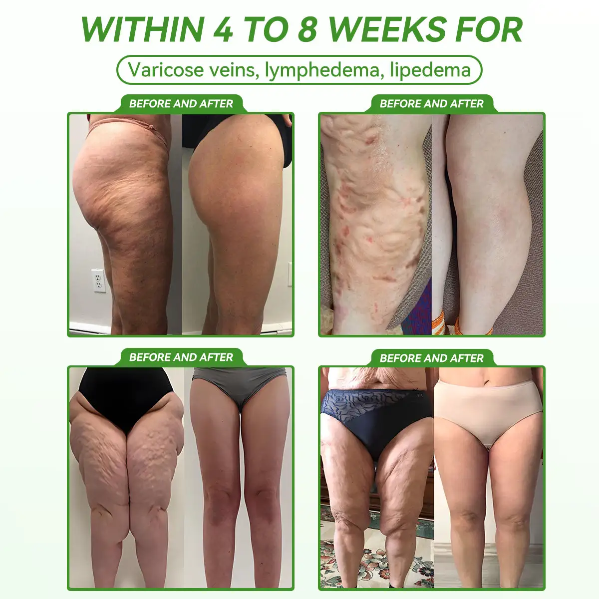 ๐บ๐ธ๐๐๐๐ข๐๐ข๐๐ฅ ๐๐ข๐ซ๐๐๐ญ ๐๐๐ฅ๐๐ฌ๐ฉโโ๏ธ|๐๐๐๐๐๐๐๐ยฎ ๐๐๐-๐ ๐๐พ๐ญ๐๐๐ผ๐ฅ๐ข๐ ๐๐๐ฅ๐๐ง๐๐ฒ ๐ข๐ซ๐๐ฅ ๐๐ฆ๐ฉ๐ผ๐ฎ๐ฅ๐ฒ (๐
๐จ๐ซ ๐จ๐๐๐ฌ๐ข๐ญ๐ฒ, ๐ฏ๐๐ซ๐ข๐๐จ๐ฌ๐ ๐ฏ๐๐ข๐ง๐ฌ, ๐๐จ๐ง๐ ๐๐ข๐ฌ๐จ๐ซ๐๐๐ซ๐ฌ, ๐๐๐ซ๐๐ข๐จ๐ฉ๐ฎ๐ฅ๐ฆ๐จ๐ง๐๐ซ๐ฒ ๐ก๐๐๐ฅ๐ญ๐ก, ๐๐๐ซ๐๐ข๐จ๐ฏ๐๐ฌ๐๐ฎ๐ฅ๐๐ซ ๐๐ข๐ฌ๐๐๐ฌ๐, ๐๐ข๐๐๐๐ญ๐๐ฌ, ๐๐ง๐ ๐ฆ๐จ๐ซ๐) โจ