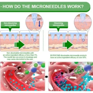 ๐ด๐ผ๐น๐พ๐ถ๐ตยฎ ๐๐ฒ๐ฟ๐ฏ๐ฒ๐ฟ๐ถ๐ป๐ฒ ๐๐-๐ข๐ง-๐ ๐ก๐ฎ๐ป๐ผ ๐ ๐ถ๐ฐ๐ฟ๐ผ๐ป๐ฒ๐ฒ๐ฑ๐น๐ฒ ๐ฃ๐ฎ๐๐ฐ๐ต